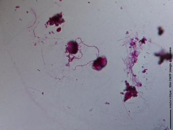 P001 100x.JPG
